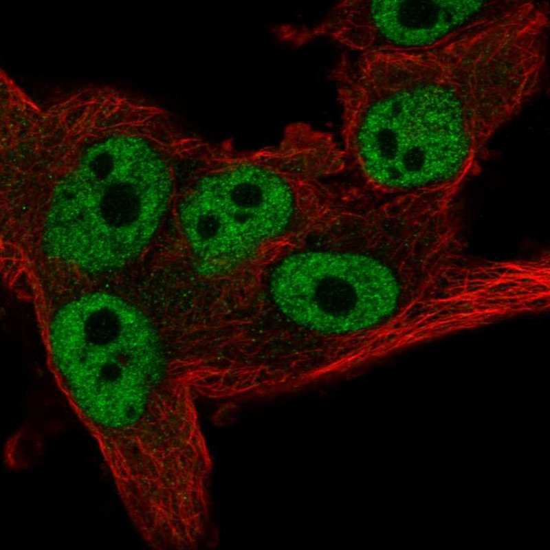 Immunofluorescent staining of human cell line SK-MEL-30 shows localization to nucleoplasm.