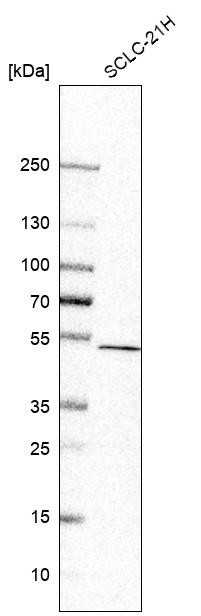Western blot analysis in human cell line SCLC-21H.