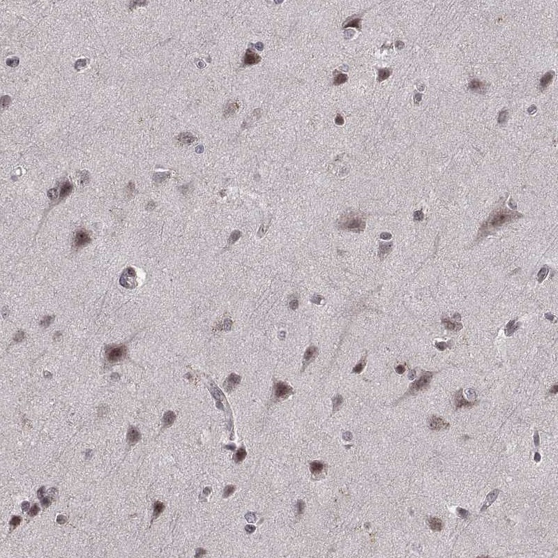 Immunohistochemical staining of human cerebral cortex shows moderate cytoplasmic and nuclear positivity in neuronal cells.