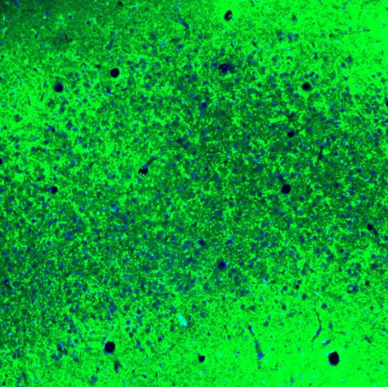Immunofluorescence staining of mouse brain cortex shows strong cytoplasmic positivity in neuropil.