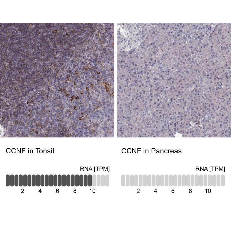 Immunohistochemistry analysis in human tonsil and pancreas tissues using Anti-CCNF antibody. Corresponding CCNF RNA-seq data are presented for the same tissues.