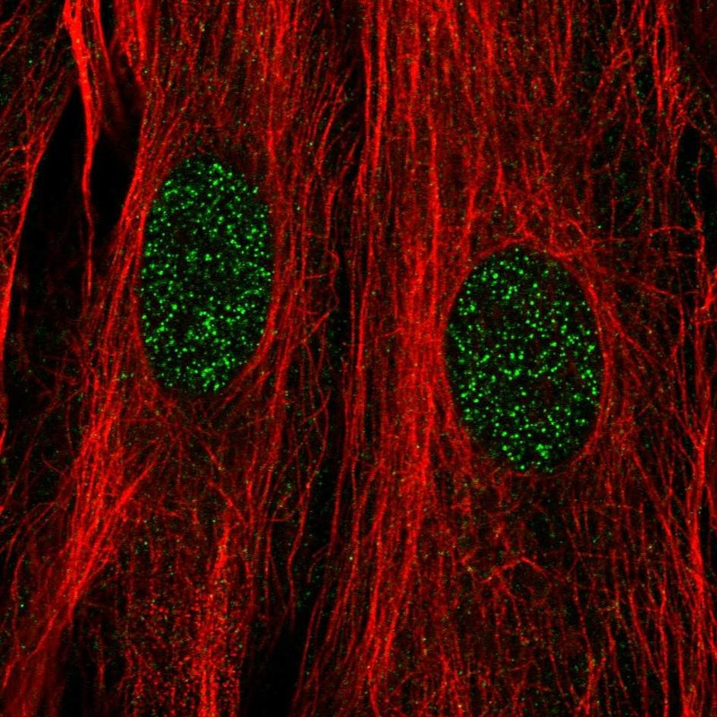 Immunofluorescent staining of human cell line BJ shows localization to nucleoplasm.