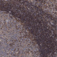 Immunohistochemical staining of human tonsil shows strong cytoplasmic positivity in germinal center and non-germinal center cells.