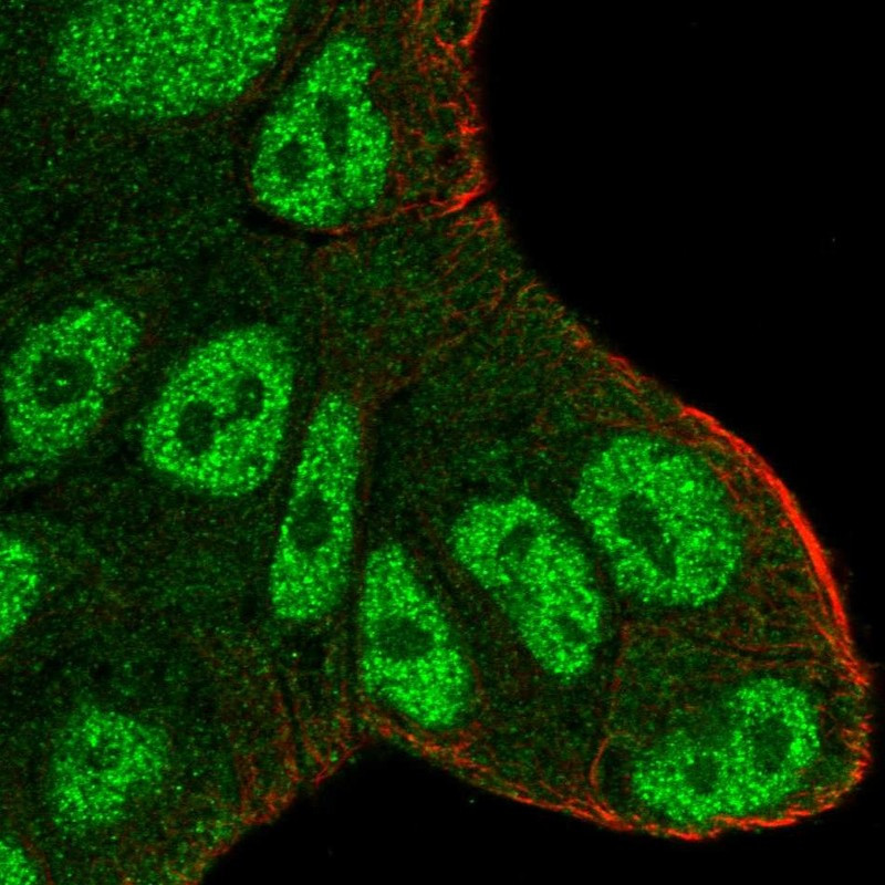 Immunofluorescent staining of human cell line RT4 shows localization to nucleoplasm & cytosol.