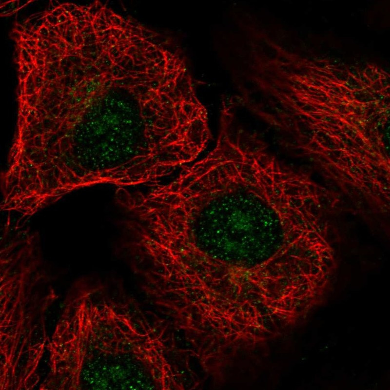 Immunofluorescent staining of human cell line A549 shows localization to nucleoli.