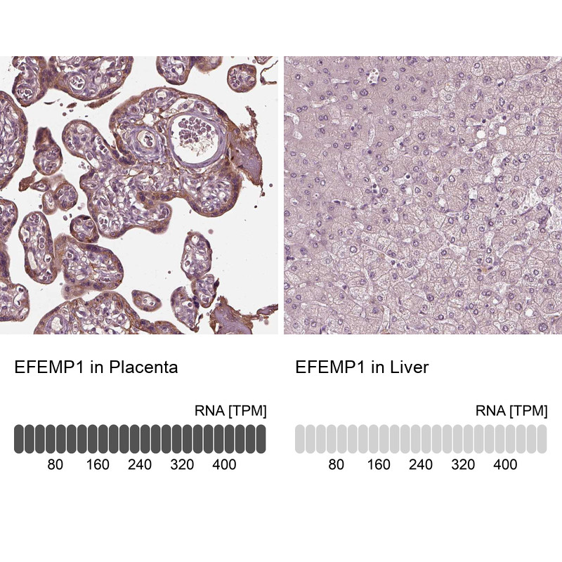 Immunohistochemistry analysis in human placenta and liver tissues using HPA070841 antibody. Corresponding EFEMP1 RNA-seq data are presented for the same tissues.