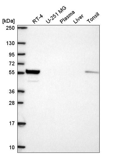 Western blot analysis in human cell line RT-4, human cell line U-251 MG, human plasma, human liver tissue and human tonsil tissue.