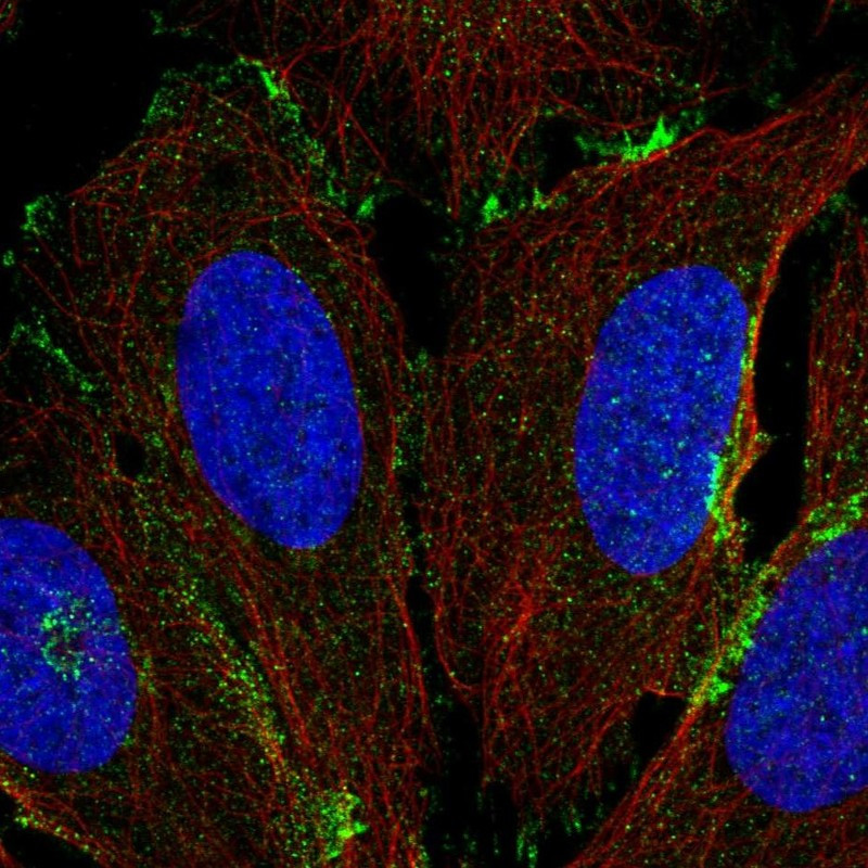 Immunofluorescent staining of human cell line U-2 OS shows localization to the Golgi apparatus, cell junctions & vesicles.