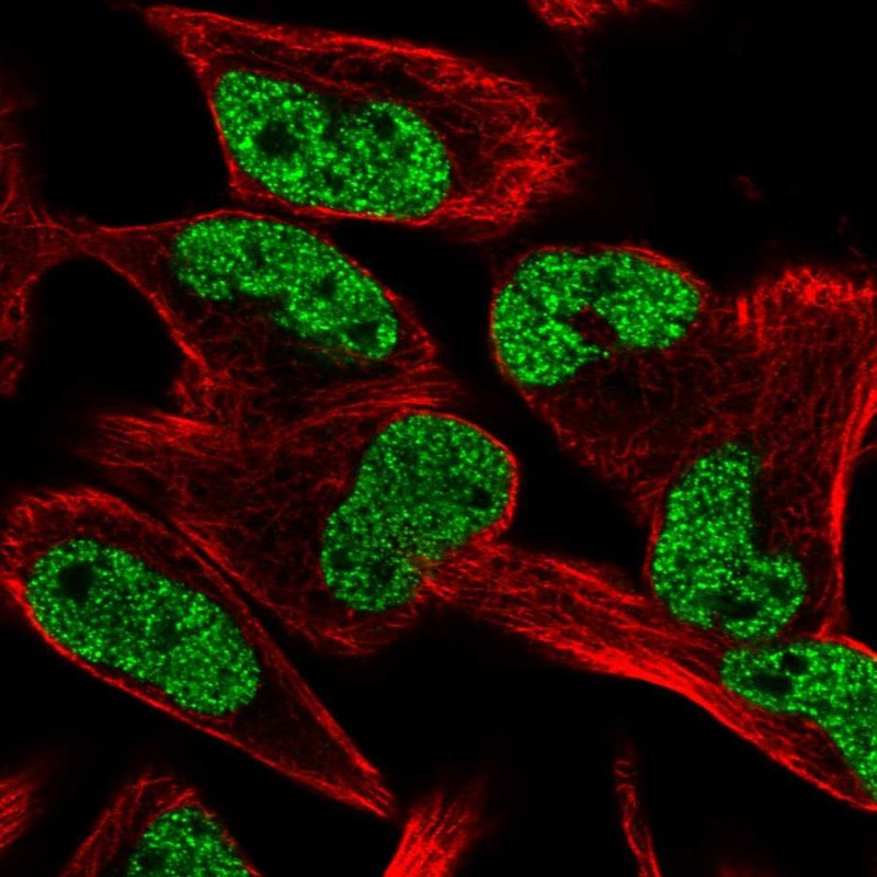 Immunofluorescent staining of human cell line RH-30 shows localization to nucleoplasm.