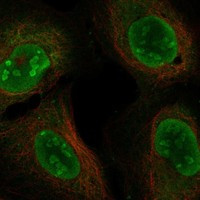 Immunofluorescent staining of human cell line U-2 OS shows localization to nucleoplasm & nucleoli.