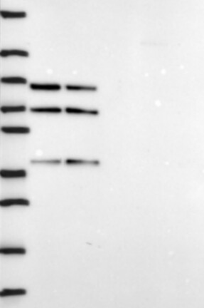 Lane 1: Marker [kDa] 250, 130, 95, 72, 55, 36, 28, 17, 10 | Lane 2: RT4 | Lane 3: U-251 MG | Lane 4: Human Plasma | Lane 5: Liver | Lane 6: Tonsil