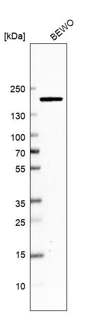 Western blot analysis in human cell line BEWO.