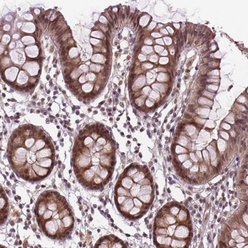 Immunohistochemical staining of human colon shows moderate nuclear positivity in glandular cells.