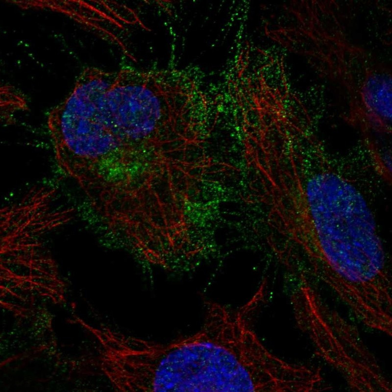 Immunofluorescent staining of human cell line HeLa shows localization to plasma membrane & cytosol.