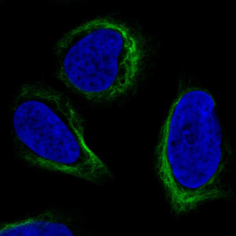 Immunofluorescent staining of human cell line U-2 OS shows localization to intermediate filaments.