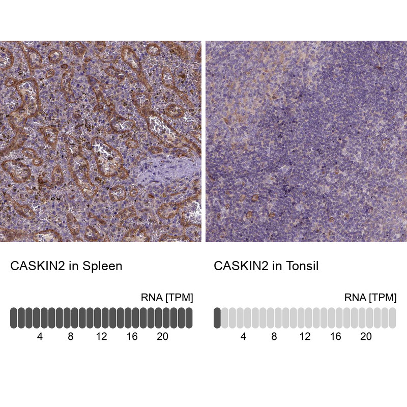 Immunohistochemistry analysis in human spleen and tonsil tissues using Anti-CASKIN2 antibody. Corresponding CASKIN2 RNA-seq data are presented for the same tissues.