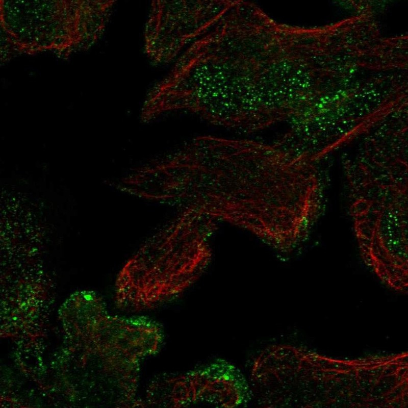Immunofluorescent staining of human cell line RH-30 shows localization to nucleus & plasma membrane.
