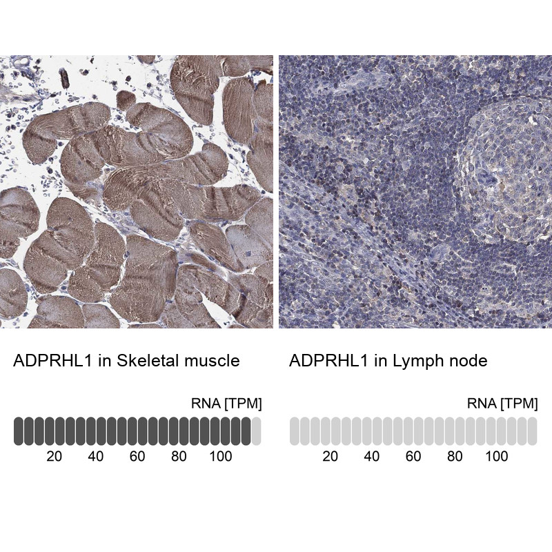 Immunohistochemistry analysis in human skeletal muscle and lymph node tissues using Anti-ADPRHL1 antibody. Corresponding ADPRHL1 RNA-seq data are presented for the same tissues.