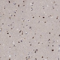 Immunohistochemical staining of human cerebral cortex shows nuclear positivity in neuronal cells and glial cells.
