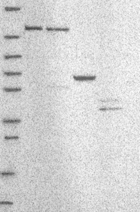 Lane 1: Marker [kDa] 250, 130, 95, 72, 55, 36, 28, 17, 10 | Lane 2: RT4 | Lane 3: U-251 MG | Lane 4: Human Plasma | Lane 5: Liver | Lane 6: Tonsil