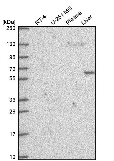 Western blot analysis in human cell line RT-4, human cell line U-251 MG, human plasma and human liver tissue.