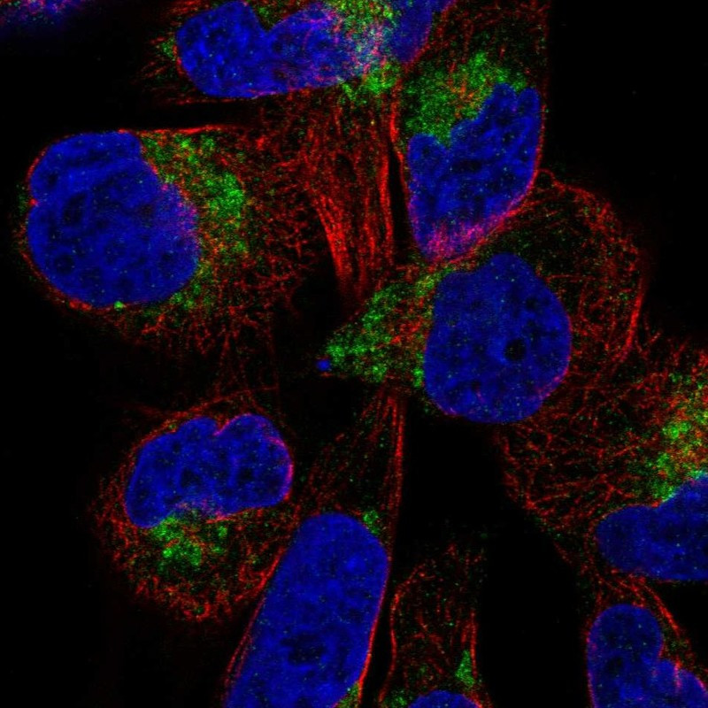 Immunofluorescent staining of human cell line RH-30 shows localization to vesicles.