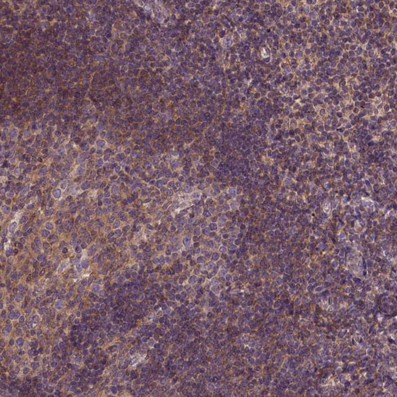 Immunohistochemical staining of human tonsil shows strong cytoplasmic positivity in non-germinal center cells.