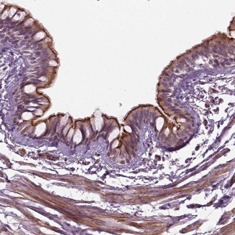 Immunohistochemical staining of human bronchus shows membranous positivity in respiratory epithelial cells.