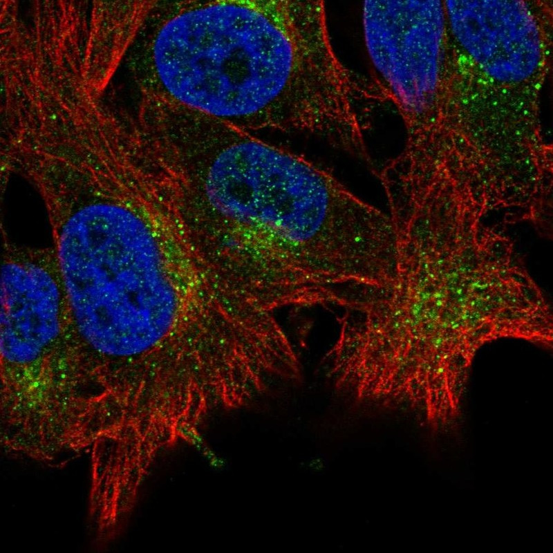 Immunofluorescent staining of human cell line SK-MEL-30 shows localization to vesicles.