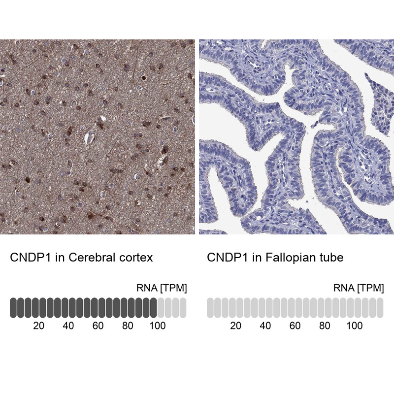 Immunohistochemistry analysis in human cerebral cortex and fallopian tube tissues using Anti-CNDP1 antibody. Corresponding CNDP1 RNA-seq data are presented for the same tissues.