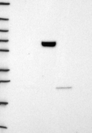 Lane 1: Marker [kDa] 250, 130, 95, 72, 55, 36, 28, 17, 10 | Lane 2: RT4 | Lane 3: U-251 MG | Lane 4: Human Plasma | Lane 5: Liver | Lane 6: Tonsil