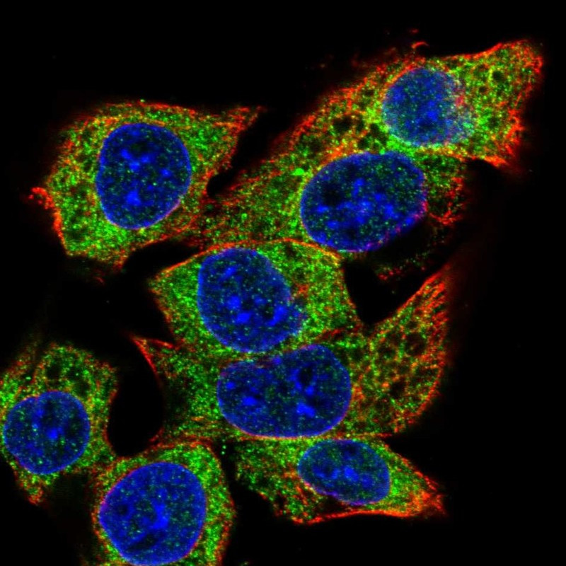 Immunofluorescent staining of human cell line Hep G2 shows localization to endoplasmic reticulum.