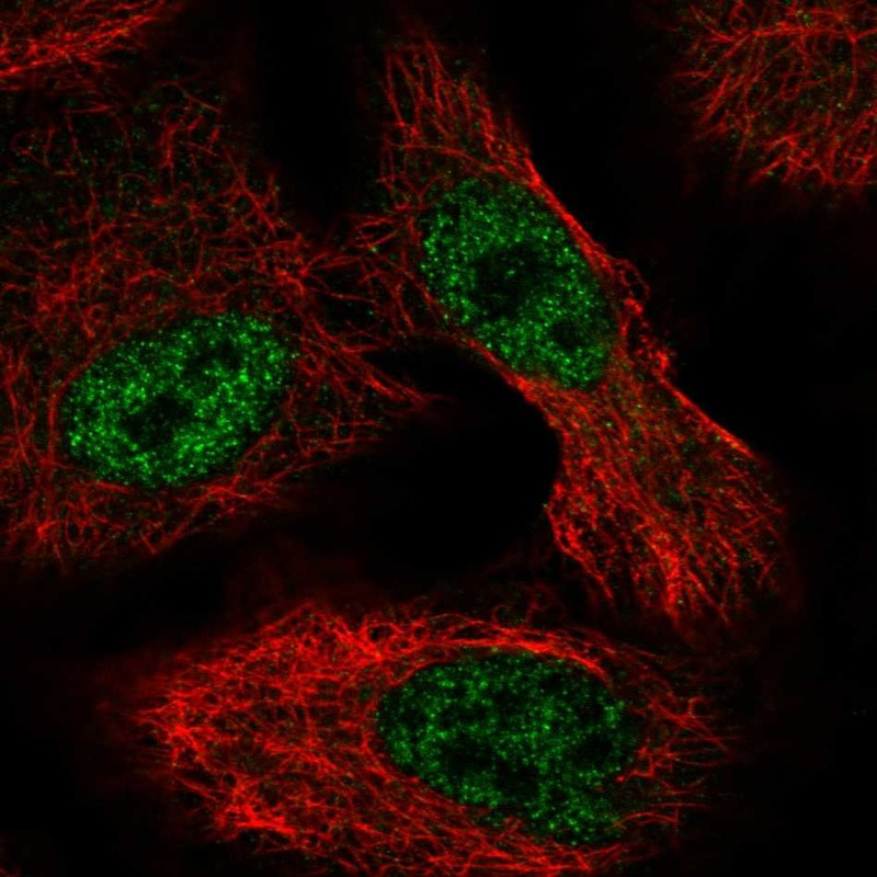Immunofluorescent staining of human cell line A549 shows localization to nucleoplasm.
