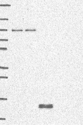 Lane 1: Marker [kDa] 250, 130, 95, 72, 55, 36, 28, 17, 10 | Lane 2: RT4 | Lane 3: U-251 MG | Lane 4: Human Plasma | Lane 5: Liver | Lane 6: Tonsil