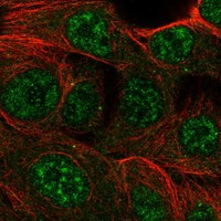 Immunofluorescent staining of human cell line MCF7 shows localization to nuclear speckles & cytosol.