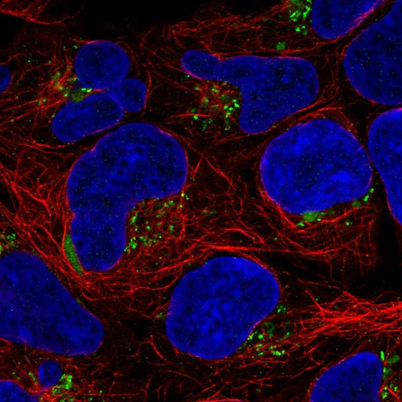 Immunofluorescent staining of human cell line HEK 293 shows localization to the Golgi apparatus & aggresome.
