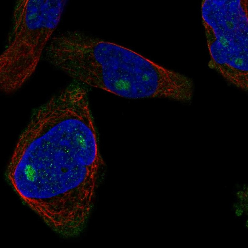 Immunofluorescent staining of human cell line RH-30 shows localization to nucleoli.