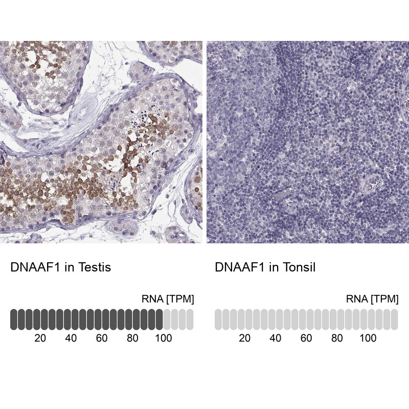Immunohistochemistry analysis in human testis and tonsil tissues using HPA074239 antibody. Corresponding DNAAF1 RNA-seq data are presented for the same tissues.