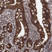 Immunohistochemical staining of human duodenum shows strong nuclear, cytoplasmic and membrane positivity in glandular cells.