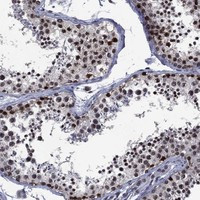 Immunohistochemical staining of human testis shows strong nuclear positivity in cells in seminiferous ducts.