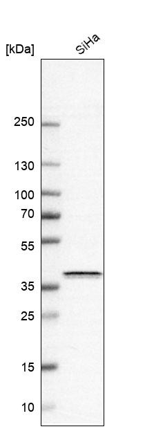 Western blot analysis in human cell line SiHa.