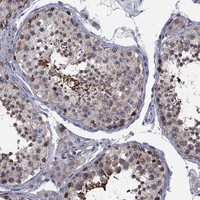 Immunohistochemical staining of human testis shows strong cytoplasmic positivity in cells in seminiferous ducts.