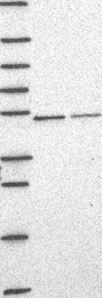 Lane 1: Marker [kDa] 250, 130, 95, 72, 55, 36, 28, 17, 10 | Lane 2: RT4 | Lane 3: U-251 MG