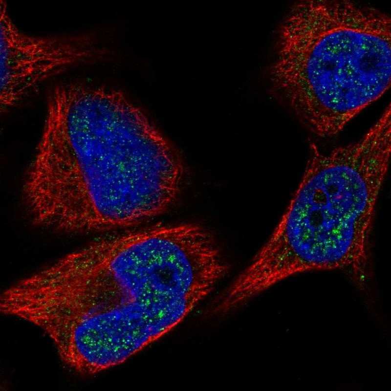 Immunofluorescent staining of human cell line SK-MEL-30 shows localization to nuclear speckles.