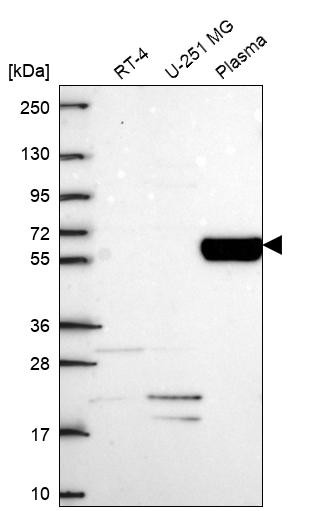 Western blot analysis in human cell line RT-4, human cell line U-251 MG and human plasma.