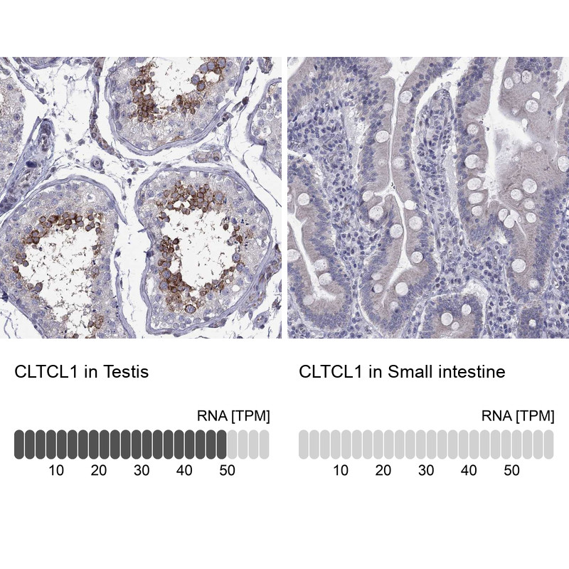 Immunohistochemistry analysis in human testis and small intestine tissues using Anti-CLTCL1 antibody. Corresponding CLTCL1 RNA-seq data are presented for the same tissues.
