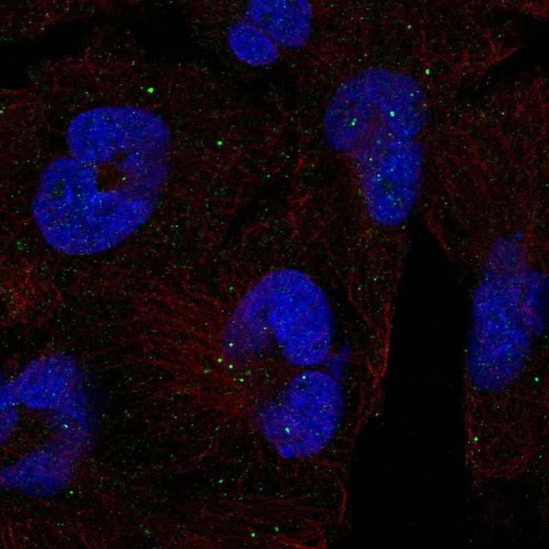 Immunofluorescent staining of human cell line RH-30 shows localization to vesicles.