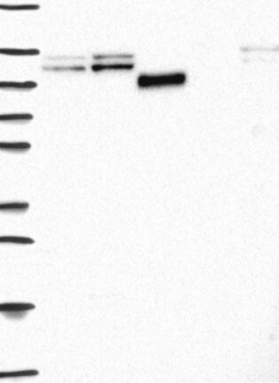 Lane 1: Marker [kDa] 250, 130, 95, 72, 55, 36, 28, 17, 10 | Lane 2: RT4 | Lane 3: U-251 MG | Lane 4: Human Plasma | Lane 5: Liver | Lane 6: Tonsil