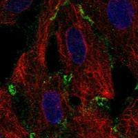 Immunofluorescent staining of human cell line A549 shows localization to plasma membrane & cell junctions.