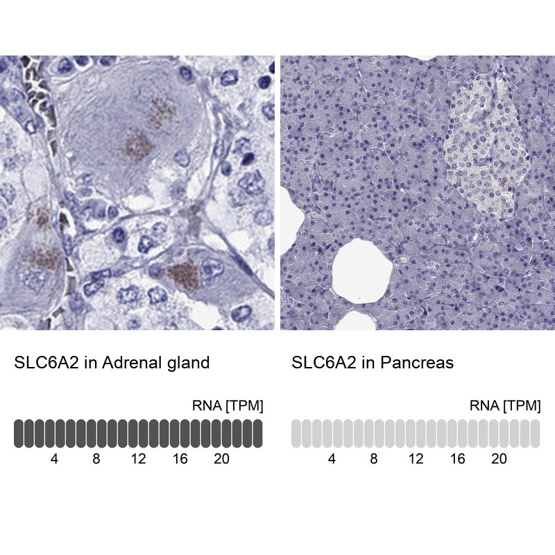 Immunohistochemistry analysis in human adrenal gland and pancreas tissues using Anti-SLC6A2 antibody. Corresponding SLC6A2 RNA-seq data are presented for the same tissues.